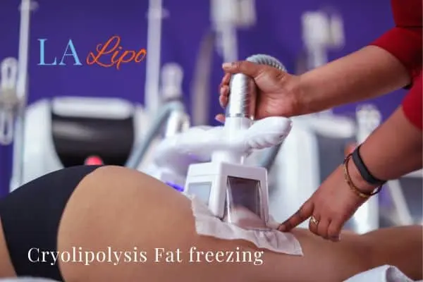 women getting fat freezing Richmond upon Thames