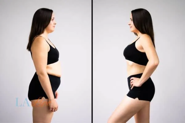link between body image and mental health Richmond upon Thames