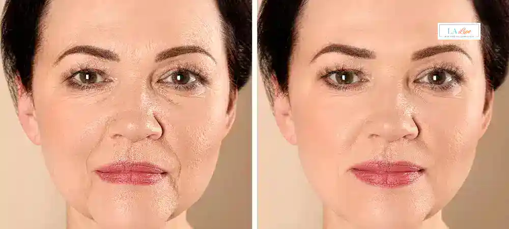 Why Aren’t My Skincare Products Making My Sagging Skin Look Firmer Richmond upon Thames?