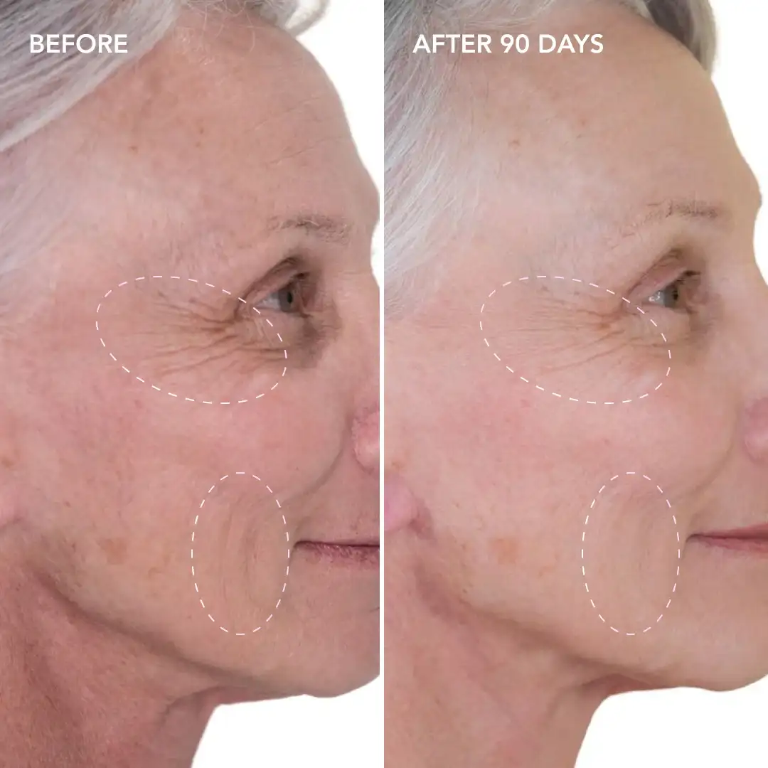 When will you see results Richmond upon Thames